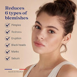 Embryolisse Anti-Blemish Face Serum: Clear Skin Solution for Oily & Combination Skin