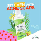 St. Ives Acne Control Tea Tree Daily Cleanser (189ml)