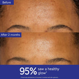 Caudalie Vinoperfect Dark Spot Correcting Moisturizer with Niacinamide