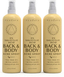 Acne Treatment Body Spray with Salicylic Acid for Back & Chest Acne, 3 Pack, Hormonal & Bacne Relief for Teens & Adults